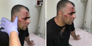 AKP’lilerin hedefindeki Gazeteci Aygül saldırıya uğradı